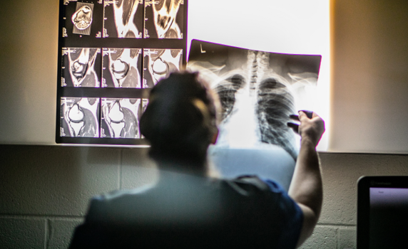 Nurse holding x-ray image